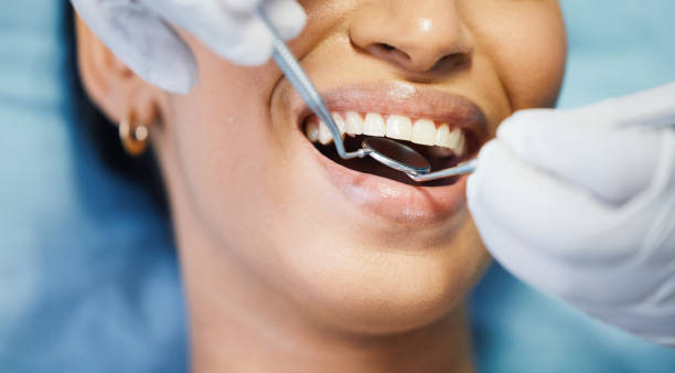 Best Dentist for Tooth Abscess  in Mangum, OK